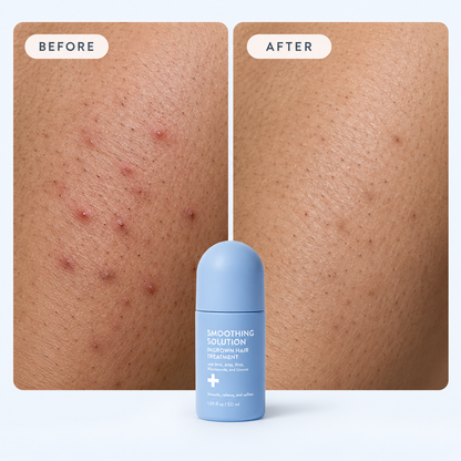 Ingrown Hair Smoothing Solution